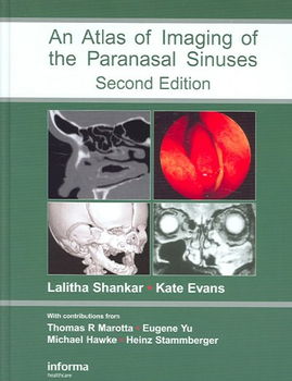 An Atlas of Imaging of the Paranasal Sinusesatlas 